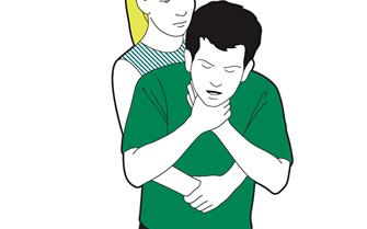 Adult choking first aid - give five abdominal thrusts