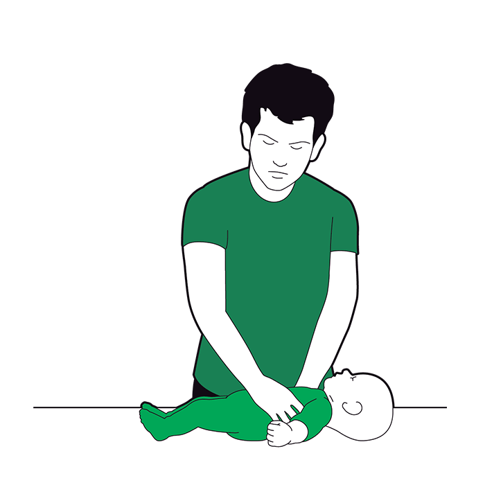 Baby primary survey - circulation - check for any signs of severe bleeding