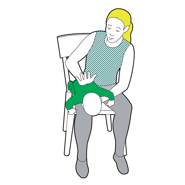 Baby choking - give five sharp back blows