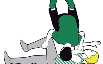 Adult recovery position - pull on the far leg and roll towards you on to their side